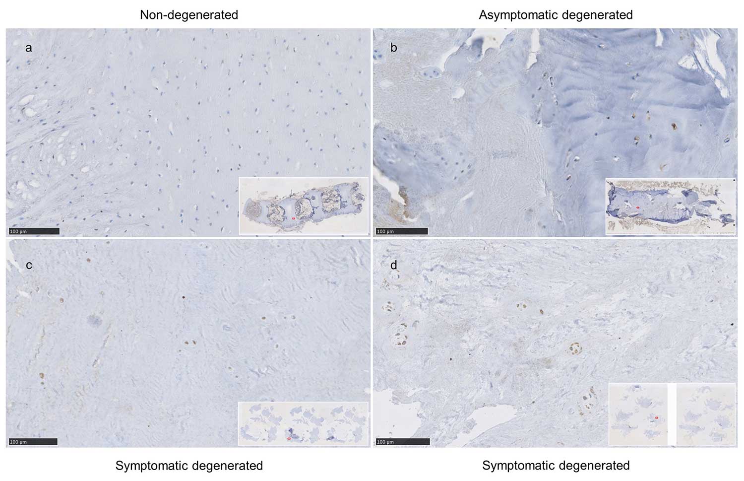 four images comparing degenerated and non-degenerated cells.
