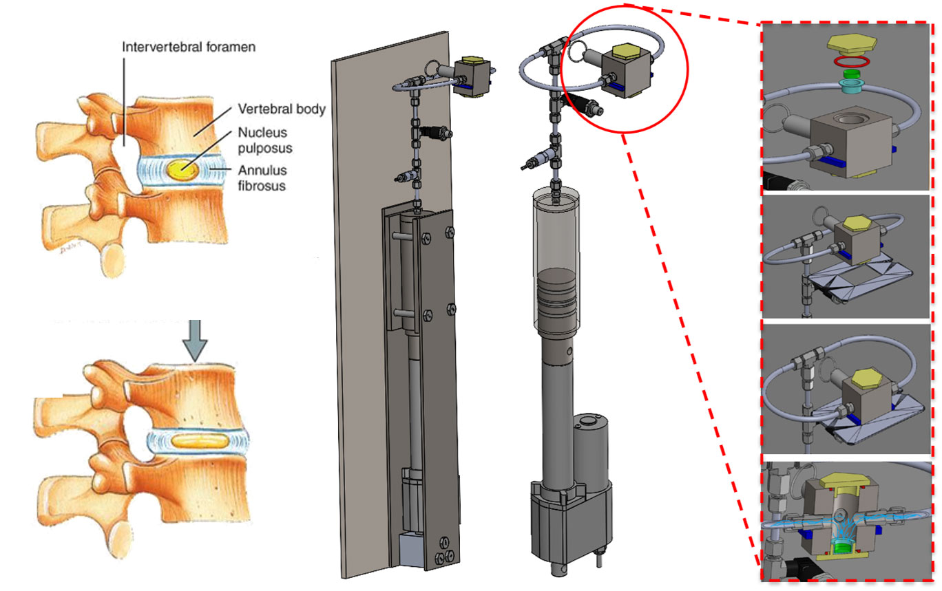 graphic of a machine that simulates compression on a spine.