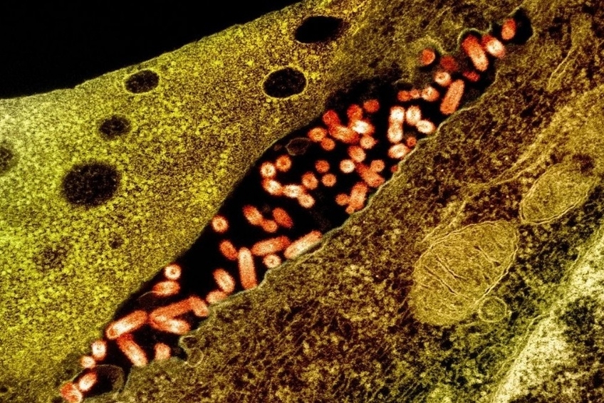 microscopic image of a viral infection, with pill-shaped bacteria inside of yellow cell structure.