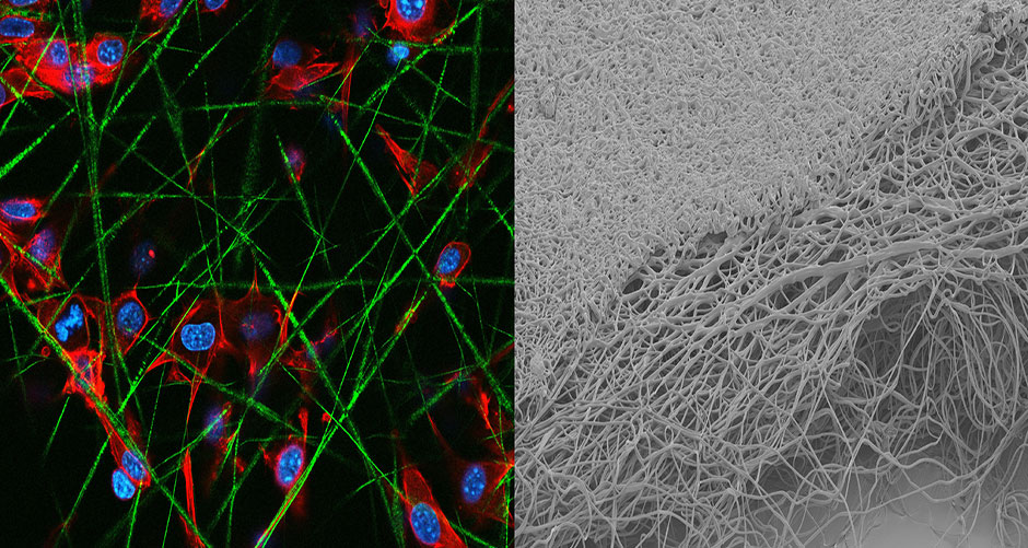 side-by-side view of different cells, one showing blue and red nuclei and green strings and the other showing a gray network of fibers.