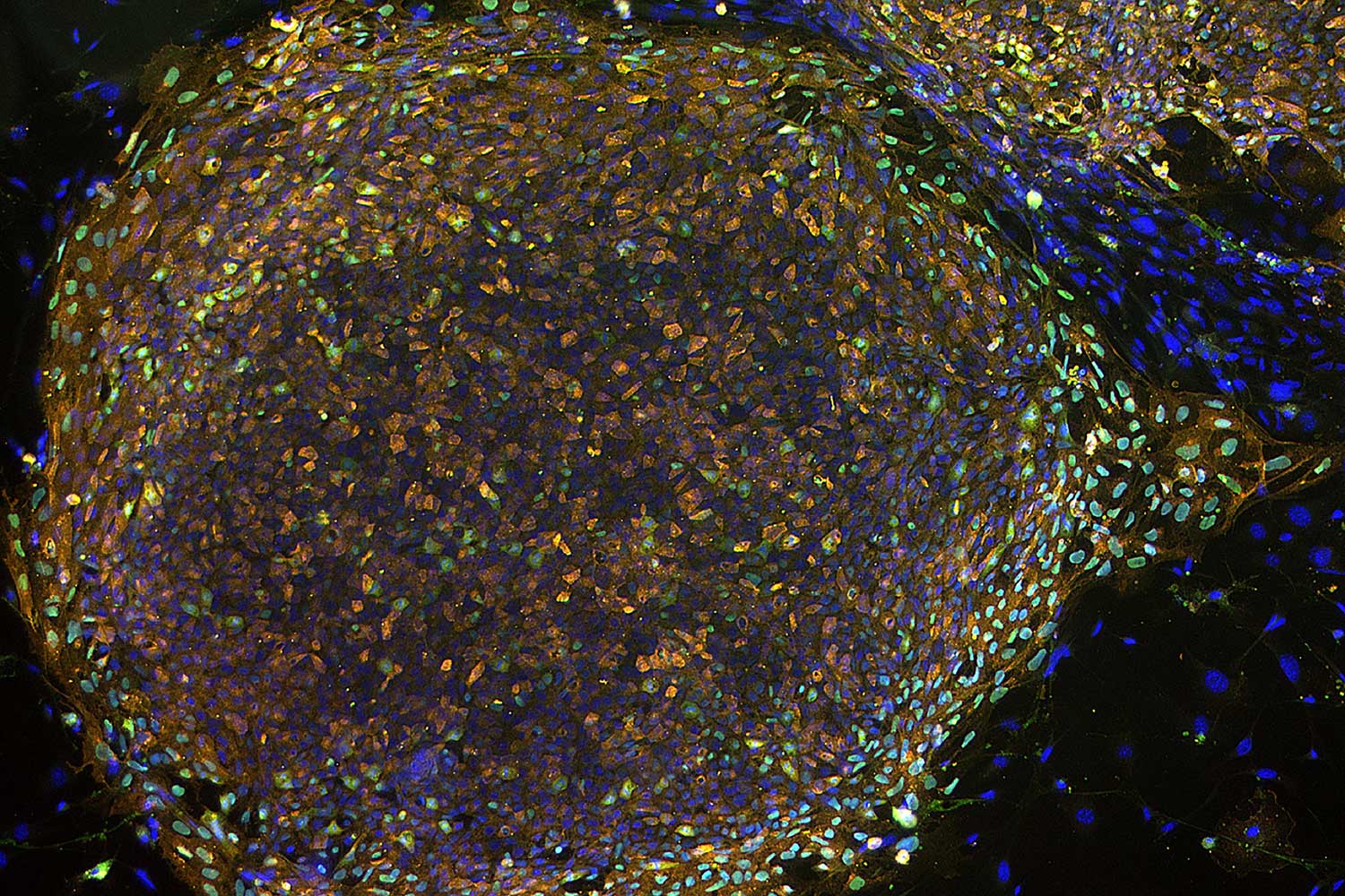 microscopic view of cells colored brown and blue, with some in green.