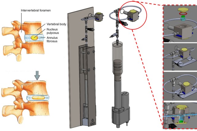 graphic of a machine that simulates compression on a spine.