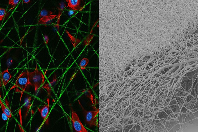 side-by-side view of different cells, one showing blue and red nuclei and green strings and the other showing a gray network of fibers.